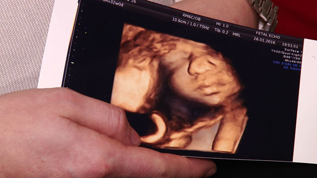 Udało się! Wojtuś przyszedł na świat!