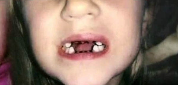 Miasto będzie dbać o uzębienie dzieci