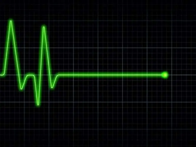 Śmierć rowerzysty w Babach k. Odolanowa