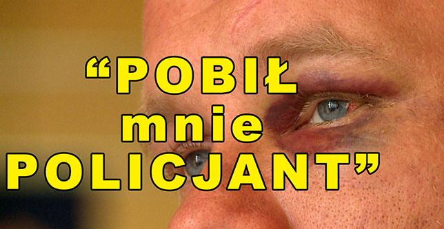 „Pobił mnie policjant”