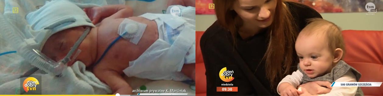 Ostrowski szpital w Dzień Dobry TVN