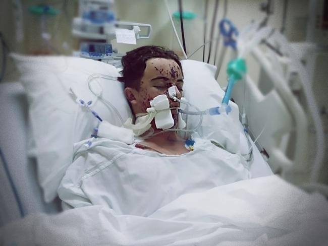 Najnowsze wieści z Dubaju. Patryk dziękuje za pomoc, ale czeka go długa droga