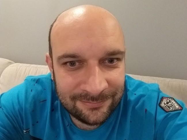 Co gdybyś to ty tracił wzrok?