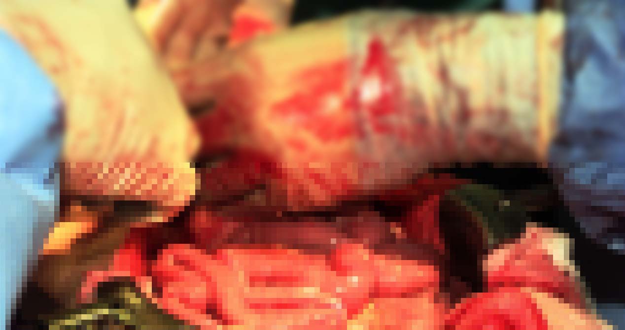Przeciął sobie brzuch i włożył dłonie do środka