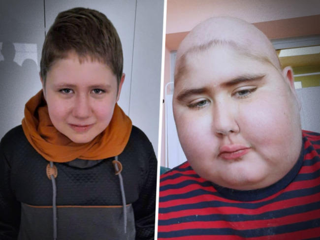 Młody ostrowianin walczy ze śmiertelnym przeciwnikiem