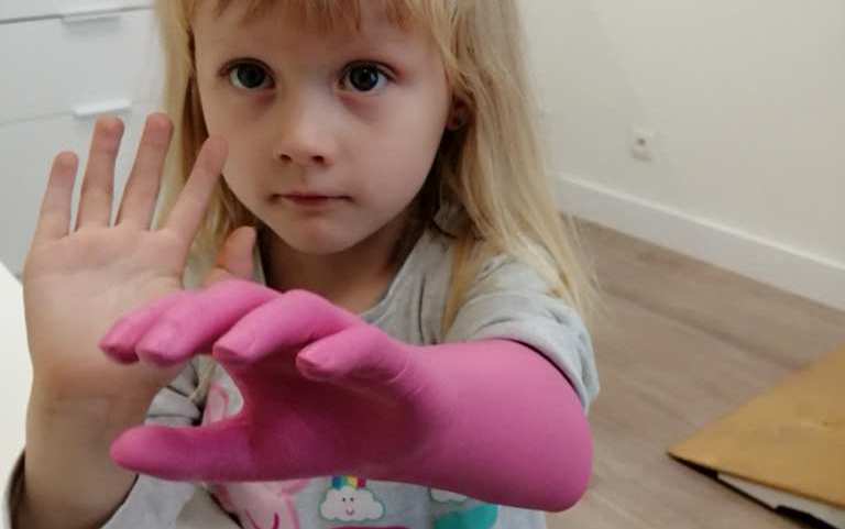 Lenka spod Ostrowa zbiera na protezę rączki