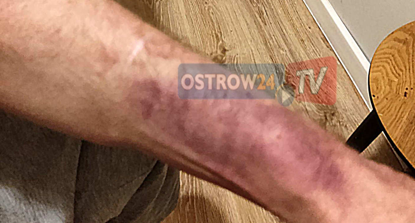 Przypięli pacjenta pasami. Dyrektor szpitala przeprasza