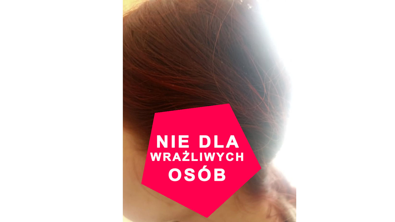 Pies w schronisku odgryzł jej ucho