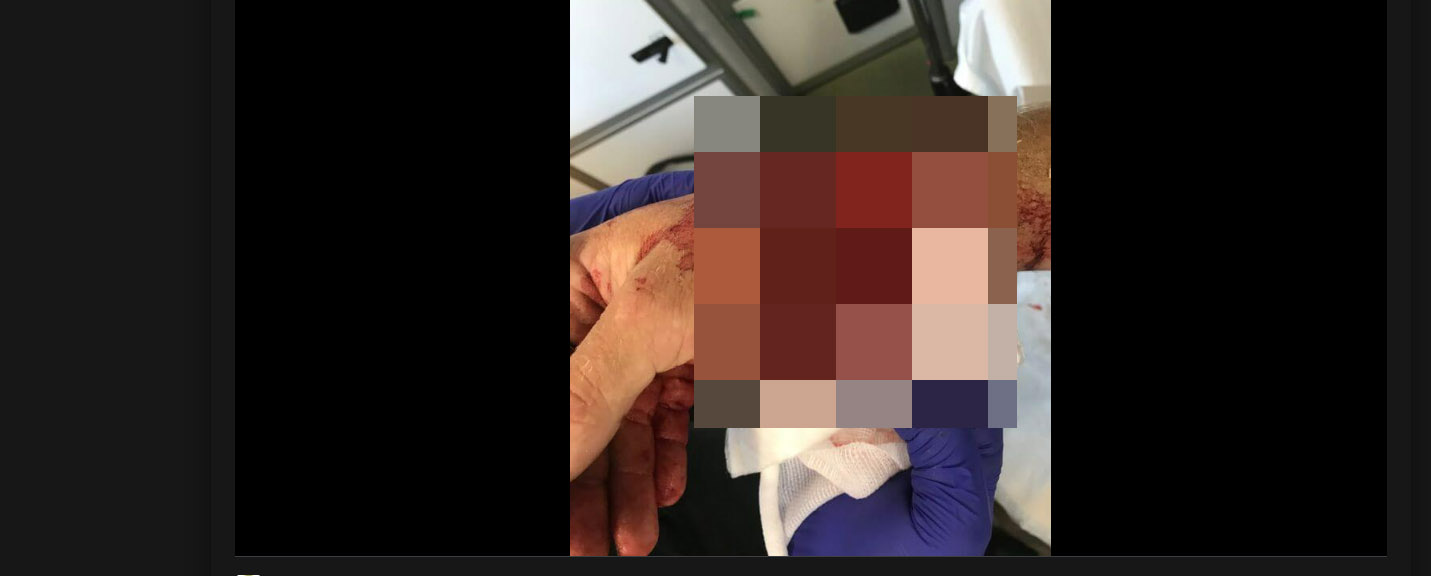 Miał rozszarpaną rękę. Anioły w mundurach wywalczyły cenne sekundy