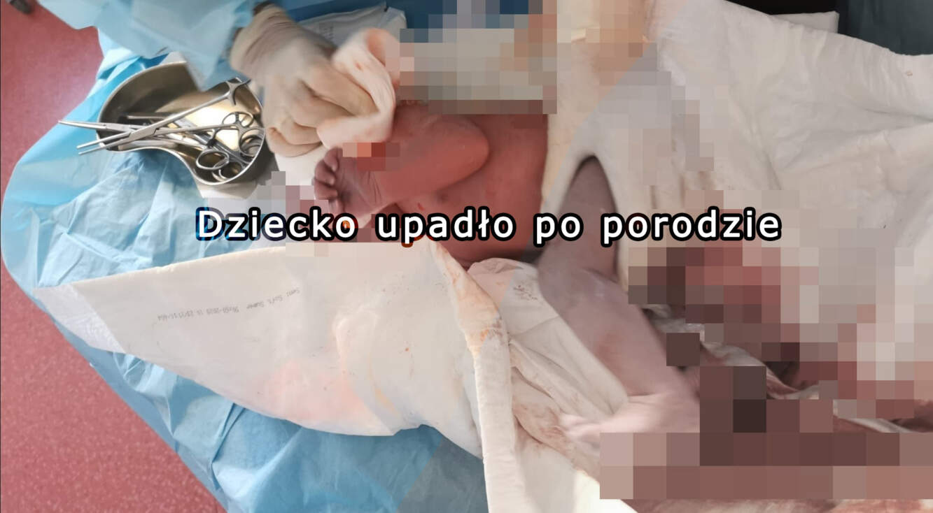 Dziecko upadło po porodzie. (aktualizacja 2)