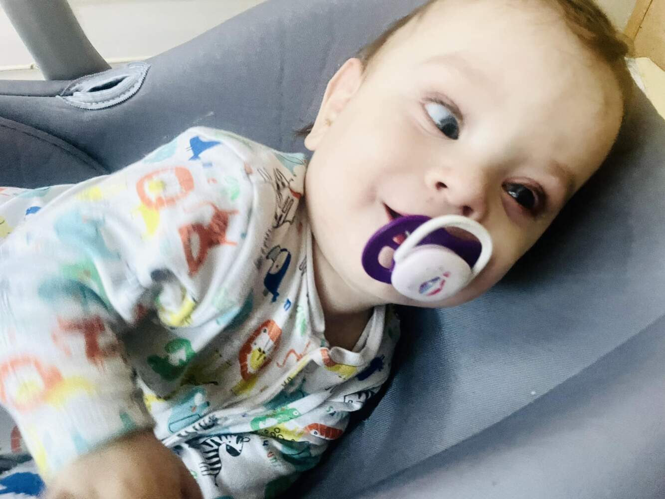 Roczny chłopiec odzyskał wzrok. Brawa dla lekarzy!