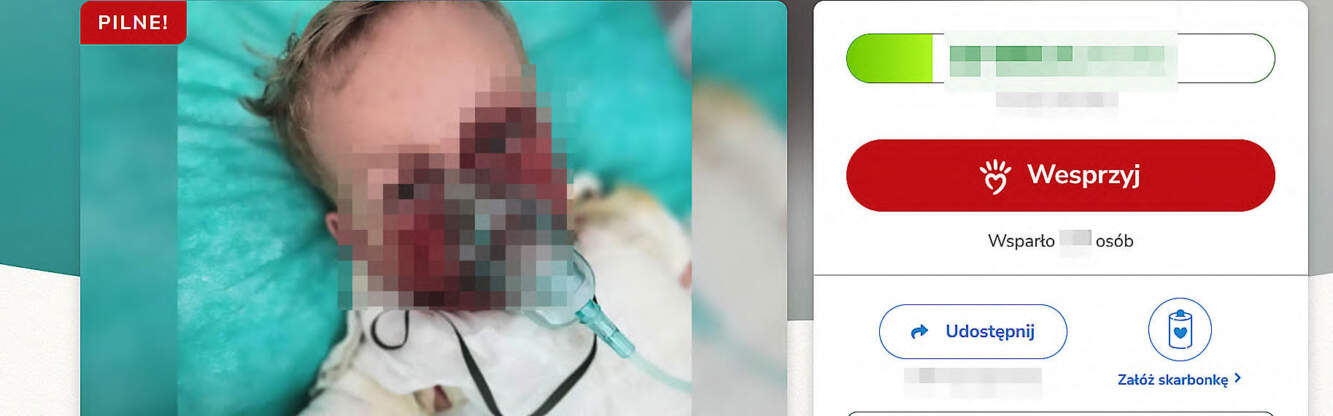 To mały Gabriel był oblany wrzątkiem. Rodzina prosi o pomoc (ZDJĘCIA)