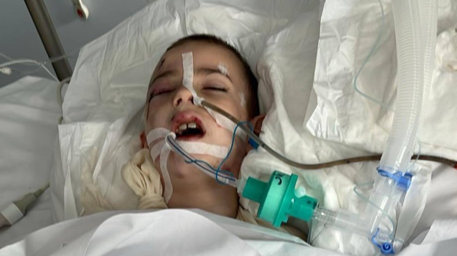 7-letni Marcinek w stanie ciężkim w szpitalu. Rodzina robi zbiórkę